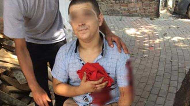 Bursa’da+madde+ba%C4%9F%C4%B1ml%C4%B1s%C4%B1+deh%C5%9Fet+sa%C3%A7t%C4%B1:+1+%C3%B6l%C3%BC,+2+yaral%C4%B1