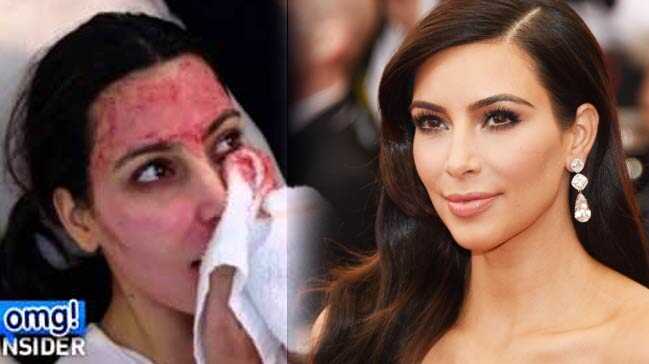 Kim Kardashian'ın 'gençlik formülü' Türkiye'ye geldi