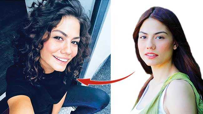 Çenesine estetik dokunuş